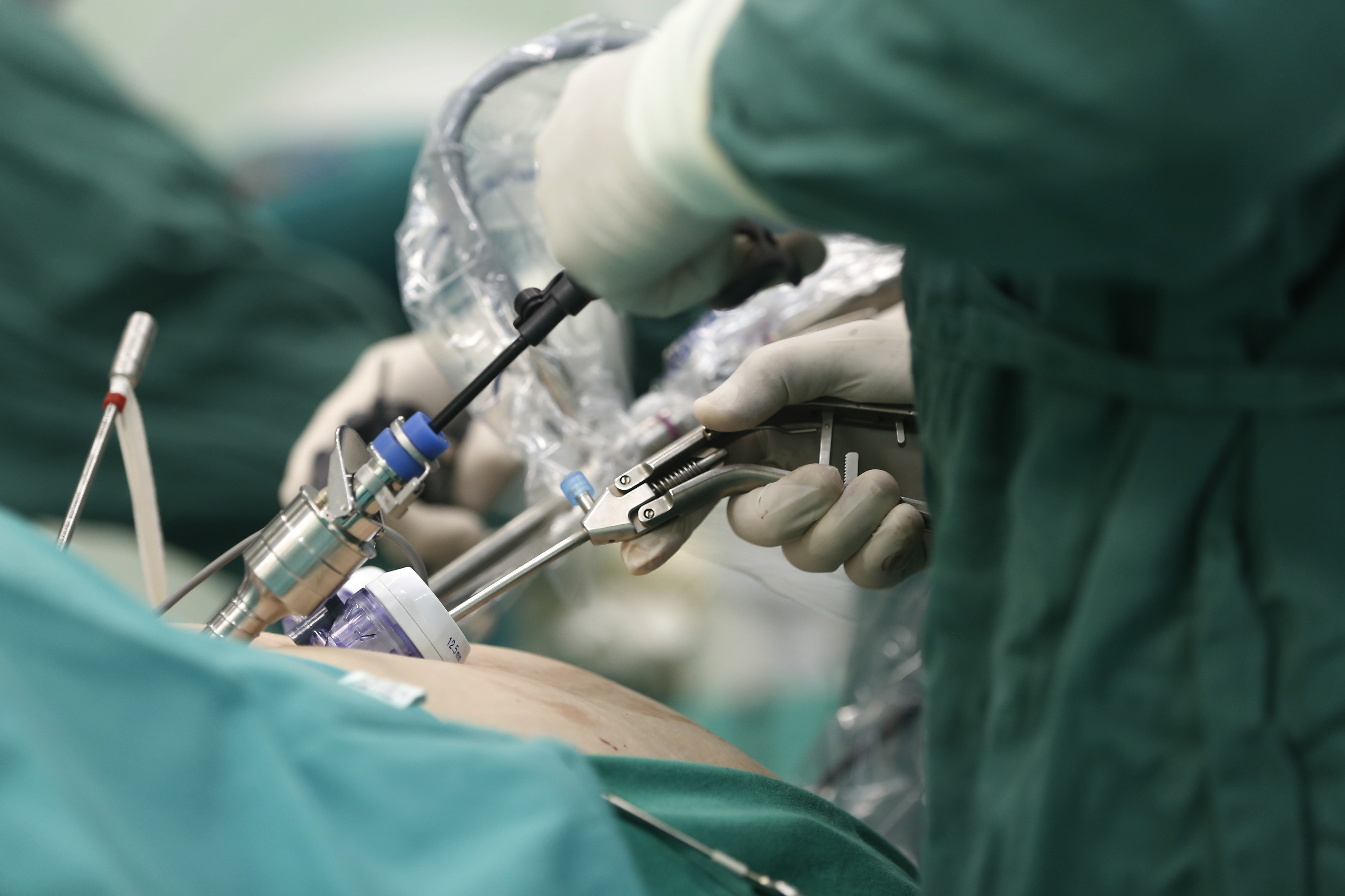 Laparoskopik ve Robotik Cerrahi Arasındaki Farklar – Minimal İnvaziv Cerrahi Rehberi