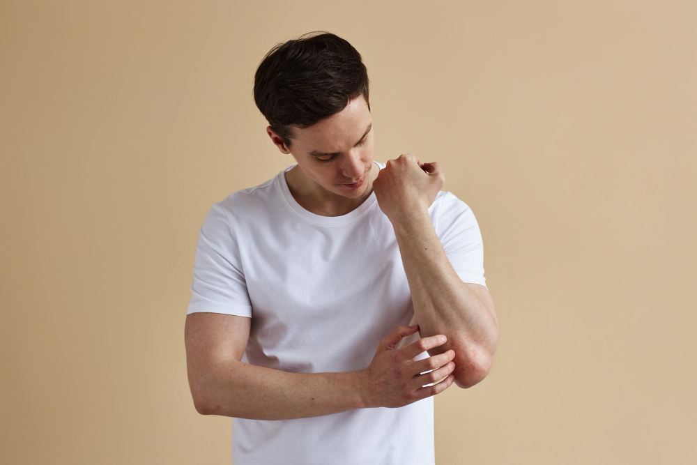 Madalyon Hastalığı (Pityriasis Rosea) Nedir Belirtileri ve Tedavisi