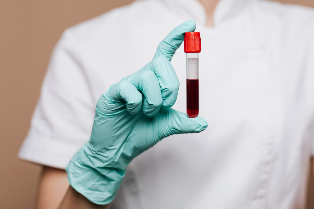 Yüksek Hemoglobin Nedir Nedenleri Belirtileri ve Tedavisi