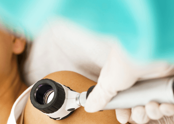 Deri ve Zührevi Hastalıkları (Dermatoloji)