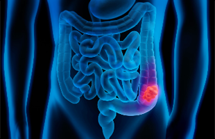 Gastroentereloji